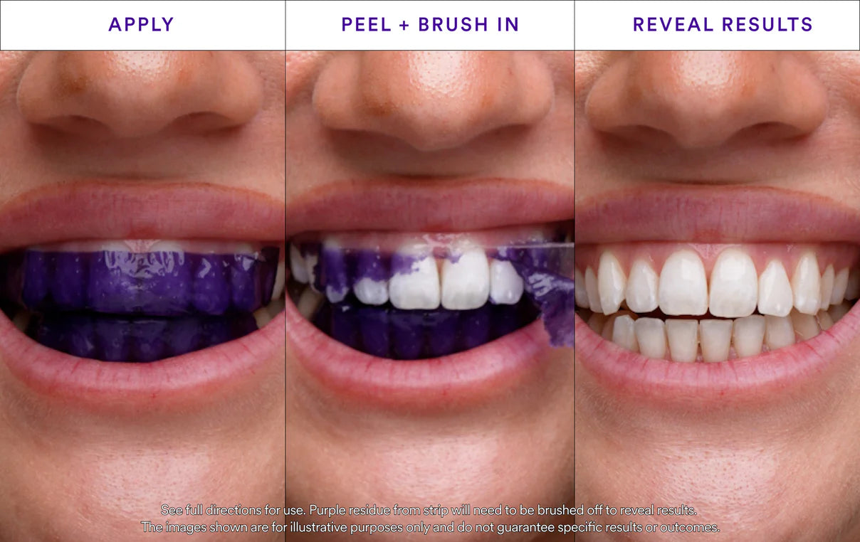 HiSmile® V34 Whitening Strips – Instant Radiance in 30 Minutes!